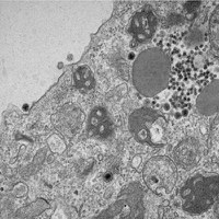 Bolsista da CAPES descobre yaravirus brasiliensis, que infecta amebas