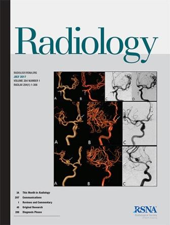 21062017 radiol 2017 284 issue 1 cover