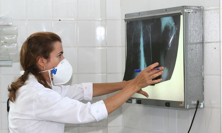 Novas tecnologias para diagnóstico e tratamento da tuberculose