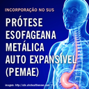 protese_esofageana