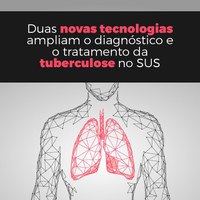 Duas novas tecnologias ampliam o diagnóstico e o tratamento da tuberculose no SUS