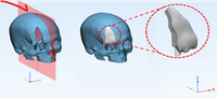 Recursos 3D contribuem para a assistência e o ensino no HU-Univasf e  Rede Ebserh