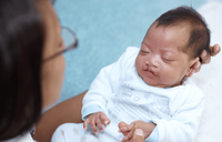 Bebês com fissura labiopalatina requerem atenção especial com a amamentação
