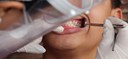 Governo Federal lança levantamento sobre saúde bucal dos brasileiros