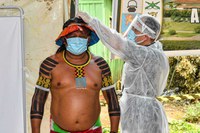 SESAI abre vagas para profissionais de saúde atuarem em aldeias do povo Kayapó