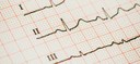 Estratégia de Saúde Cardiovascular completa um ano e orienta prevenção