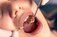 Exame de rotina na boca pode diagnosticar lesões antes de se transformarem em câncer