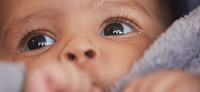 Diagnóstico precoce do retinoblastoma previne cegueira infantil