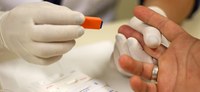 Saúde orienta farmácias autorizadas a realizar testes rápidos de HIV, hepatites virais, sífilis e ISTs